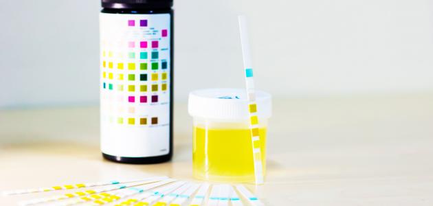 ما أسباب الزلال ما أسباب الزلال