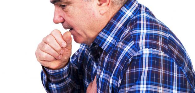 ما أسباب الكحة المستمرة ما أسباب الكحة المستمرة