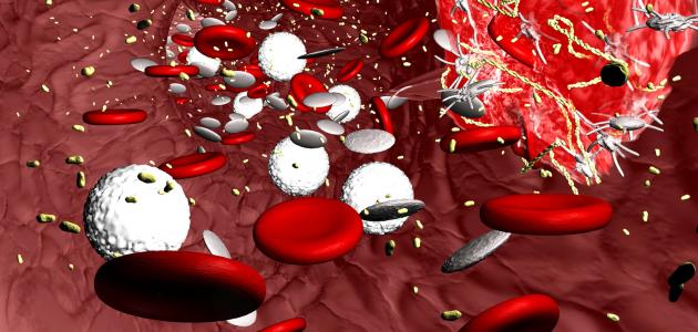 ما أسباب تخثر الدم ما أسباب تخثر الدم