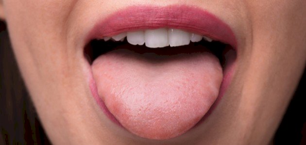 ما أسباب ثقل اللسان ما أسباب ثقل اللسان