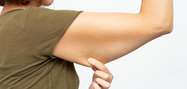 ما سبب ترهل الجسم ما سبب ترهل الجسم