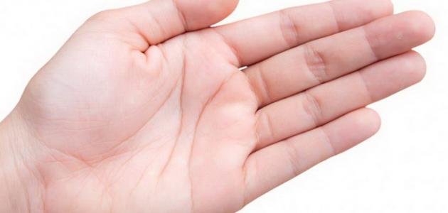 ما سبب خدر اليدين