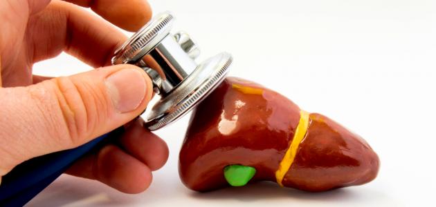 ما علاج ارتفاع إنزيمات الكبد ما علاج ارتفاع إنزيمات الكبد