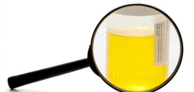 ما علاج التهاب البول ما علاج التهاب البول