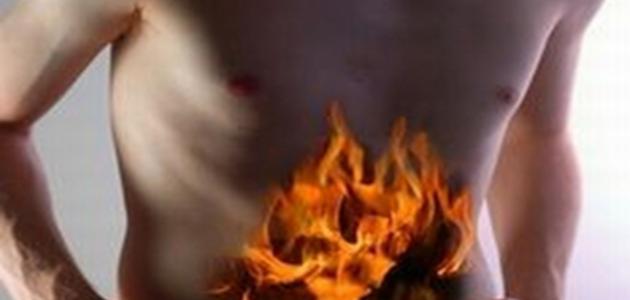 ما علاج حرقة المعدة ما علاج حرقة المعدة