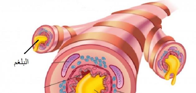 ما هو البلغم ما هو البلغم