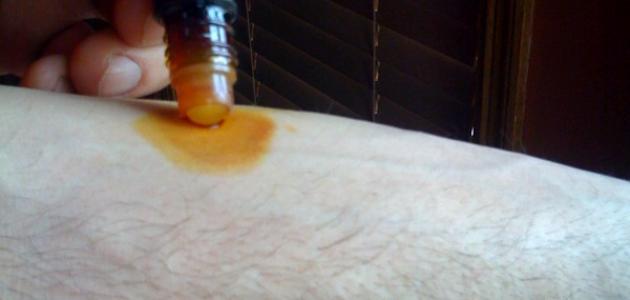 ما هو اليود ما هو اليود