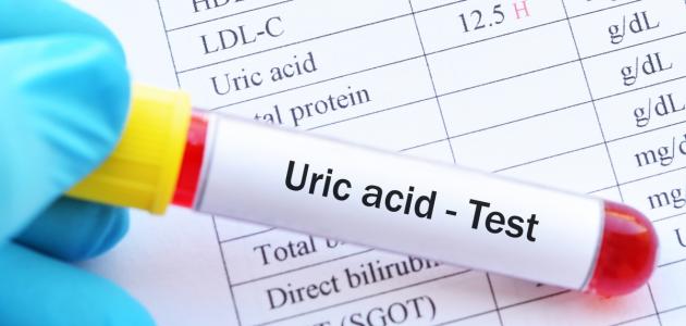 ما هو تحليل حمض البوليك ما هو تحليل حمض البوليك