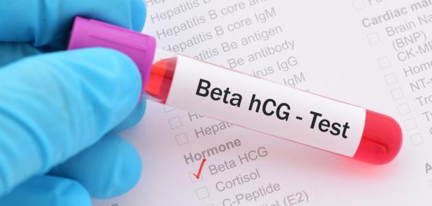 ما هو تحليل حمل رقمي ما هو تحليل حمل رقمي