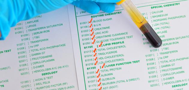 ما هو تحليل وظائف الكلى والكبد ما هو تحليل وظائف الكلى والكبد