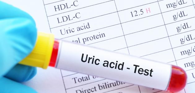 ما هو تحليل يورك أسد ما هو تحليل يورك أسد