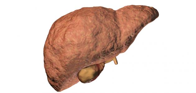ما هو تليف الكبد ما هو تليف الكبد