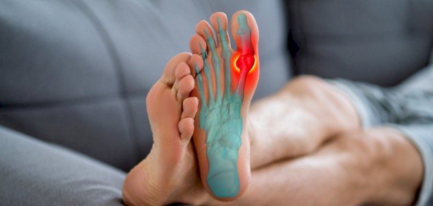 ما هو داء الملوك