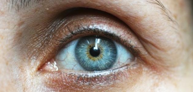 ما هو سبب وجع العين ما هو سبب وجع العين