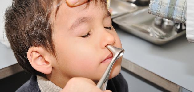 ما هو علاج احتقان الأنف ما هو علاج احتقان الأنف