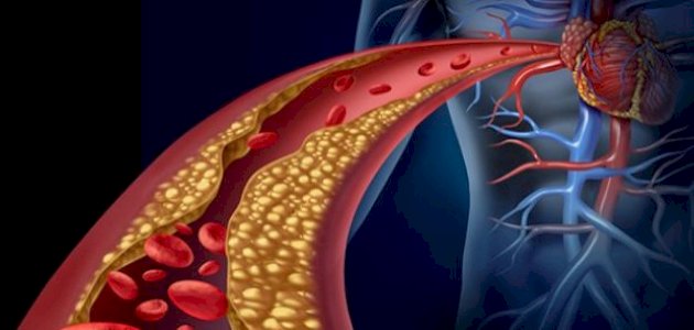 ما هو علاج الكولسترول