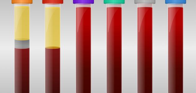 ما هو علاج تخثر الدم ما هو علاج تخثر الدم