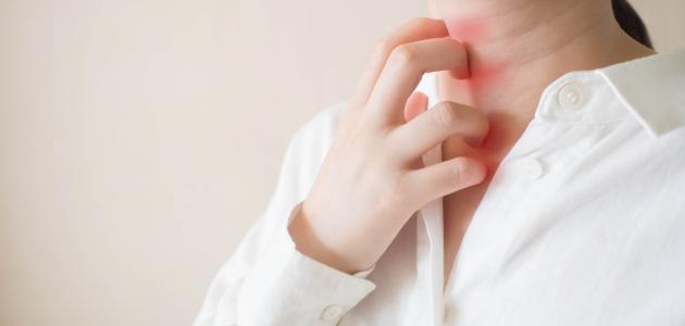 ما هو علاج حكة الجلد ما هو علاج حكة الجلد