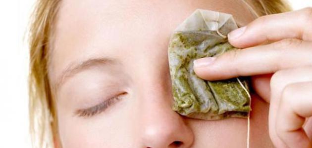 ما هو علاج سواد تحت العين