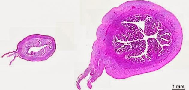 ما هو علاج صغر حجم البويضة ما هو علاج صغر حجم البويضة