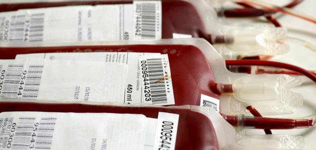 ما هو مرض الأنيميا ما هو مرض الأنيميا