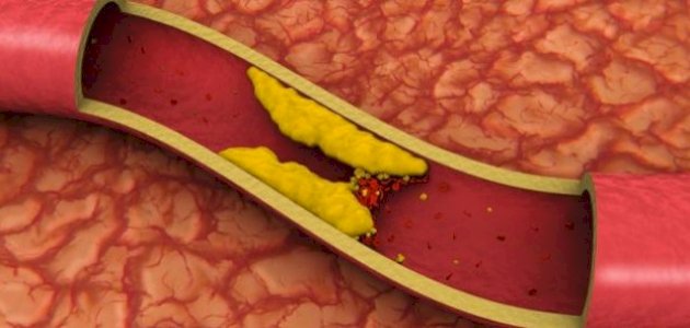 ما هو معدل الكوليسترول الطبيعي ما هو معدل الكوليسترول الطبيعي