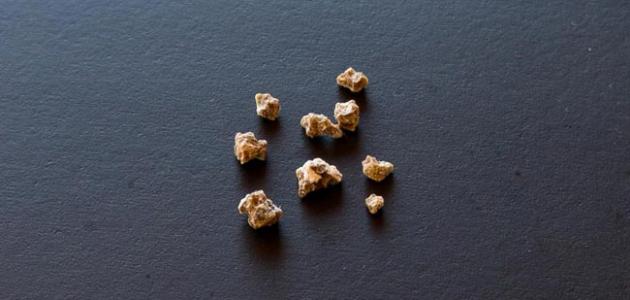 ما هي أعراض حصوات المرارة ما هي أعراض حصوات المرارة