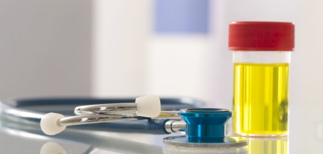 ما هي أعراض زلال البول ما هي أعراض زلال البول