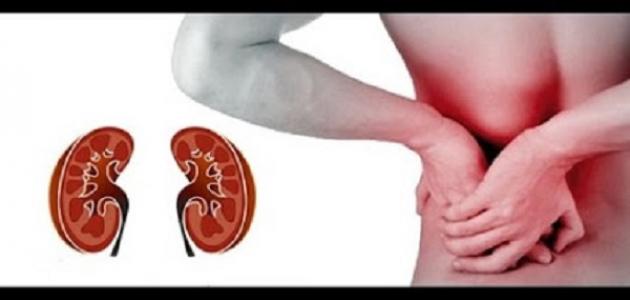 ما هي أعراض عجز الكلى ما هي أعراض عجز الكلى