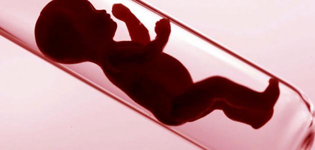 ما هي علامات نجاح عملية أطفال الأنابيب