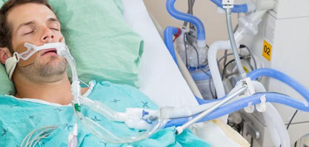 ما هي غيبوبة الكبد ما هي غيبوبة الكبد