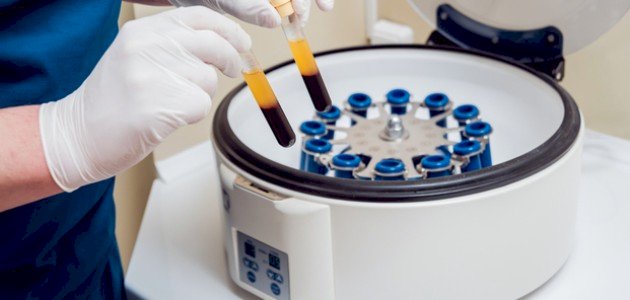 مبدأ عمل جهاز الطرد المركزي