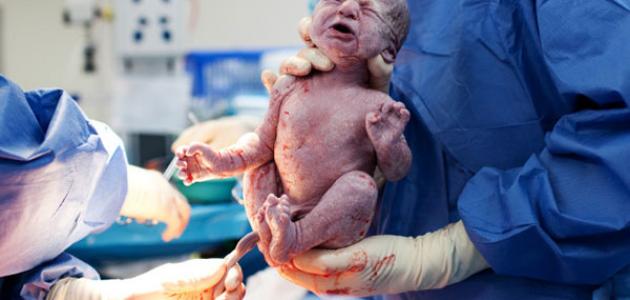 مراحل الطلق والولادة مراحل الطلق والولادة