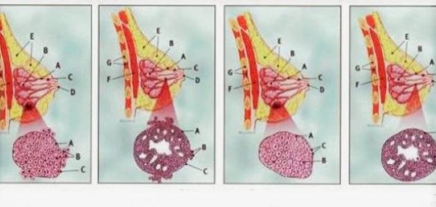 مراحل تطور سرطان الثدي مراحل تطور سرطان الثدي