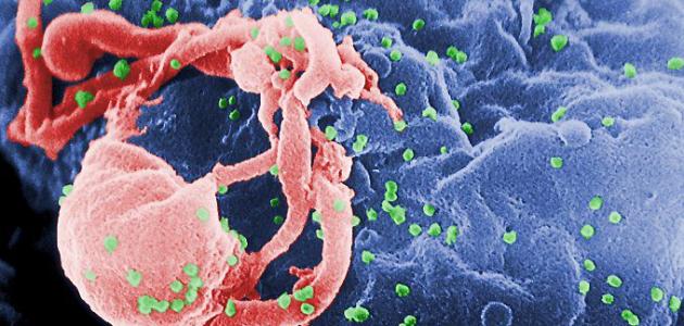 مراحل مرض الإيدز مراحل مرض الإيدز