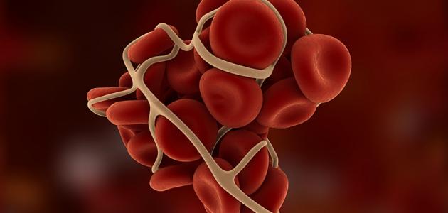 نصائح لمرضى فقر الدم نصائح لمرضى فقر الدم