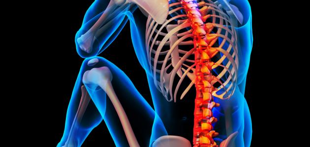 هشاشة العظام والعمود الفقري هشاشة العظام والعمود الفقري