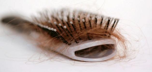 هل نقص الفيتامين يؤدي إلى تساقط الشعر هل نقص الفيتامين يؤدي إلى تساقط الشعر