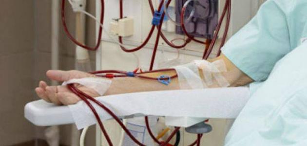 هل يسبب الفشل الكلوي الموت في مراحله المتقدمة؟