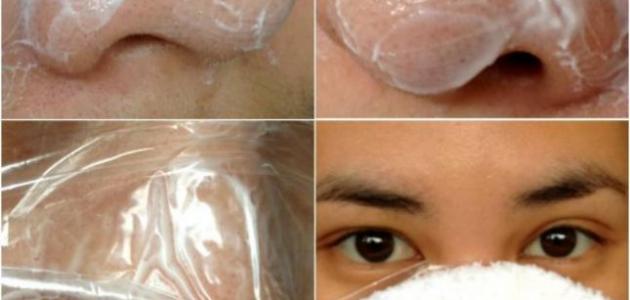 وصفات لإزالة الرؤوس السوداء وصفات لإزالة الرؤوس السوداء