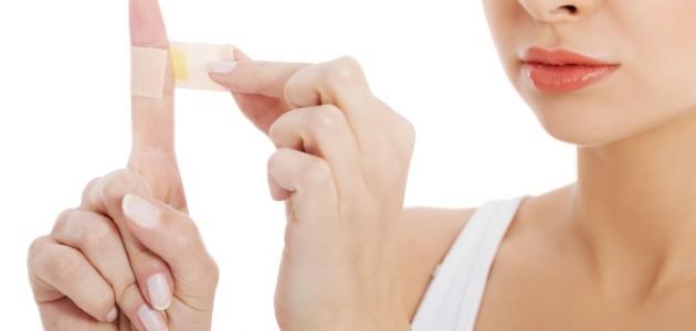 آثار الحروق السطحية آثار الحروق السطحية