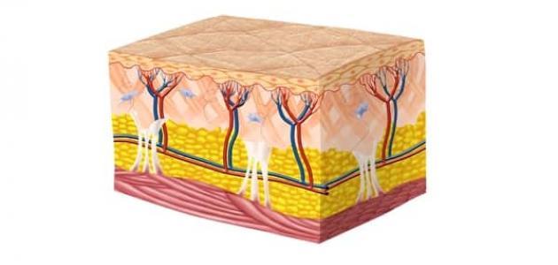 آثار حروق الدرجة الثانية