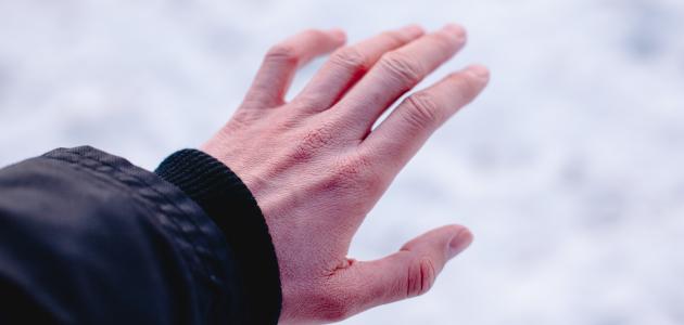 أسباب ازرقاق اليدين أسباب ازرقاق اليدين