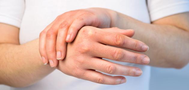 أسباب الحساسية أسباب الحساسية