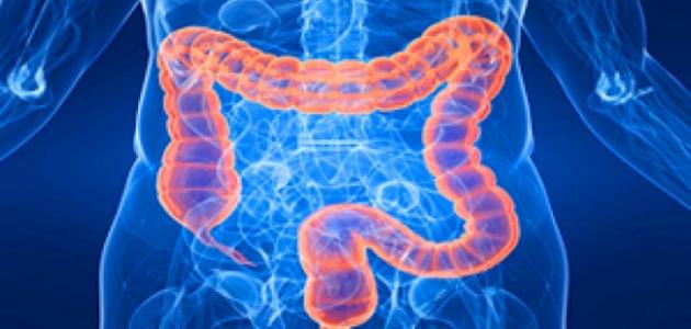 أسباب القولون الهضمي