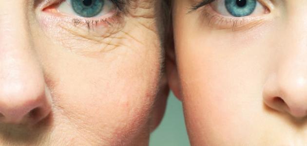 أسباب ترهل الوجه