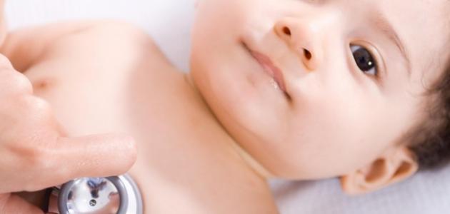 أسباب تشوهات القلب الخلقية - فيديو