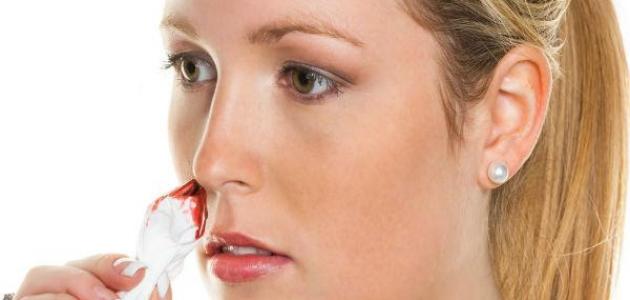 أسباب نزيف الأنف المفاجئ أسباب نزيف الأنف المفاجئ