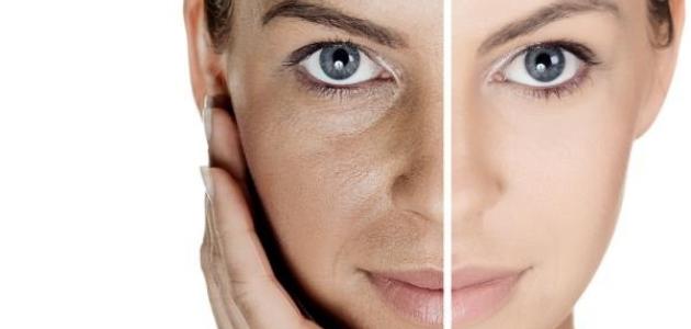 أضرار الكولاجين للبشرة أضرار الكولاجين للبشرة