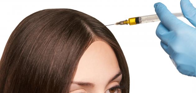 أضرار حقن البلازما للشعر أضرار حقن البلازما للشعر